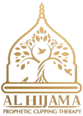 Alhijama